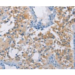 Immunohistochemistry - ATP6AP2 Antibody from Signalway Antibody (36270) - Antibodies.com