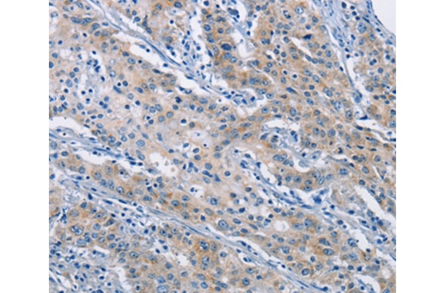 Immunohistochemistry - ATP6AP2 Antibody from Signalway Antibody (36270) - Antibodies.com