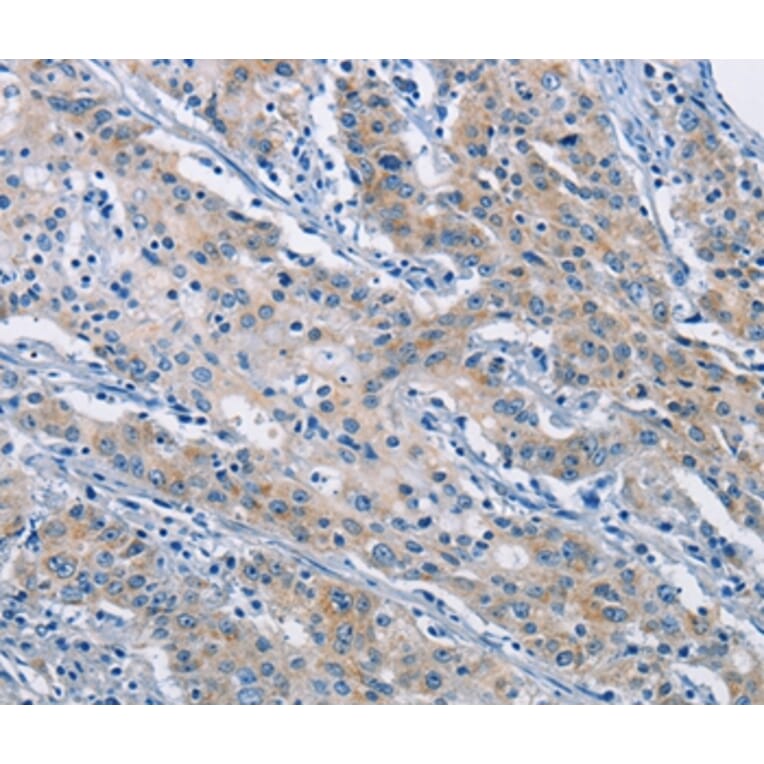 Immunohistochemistry - ATP6AP2 Antibody from Signalway Antibody (36270) - Antibodies.com