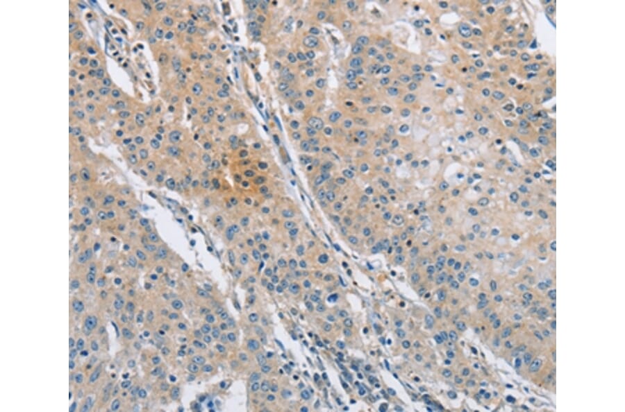 Immunohistochemistry - SH3GLB1 Antibody from Signalway Antibody (36281) - Antibodies.com