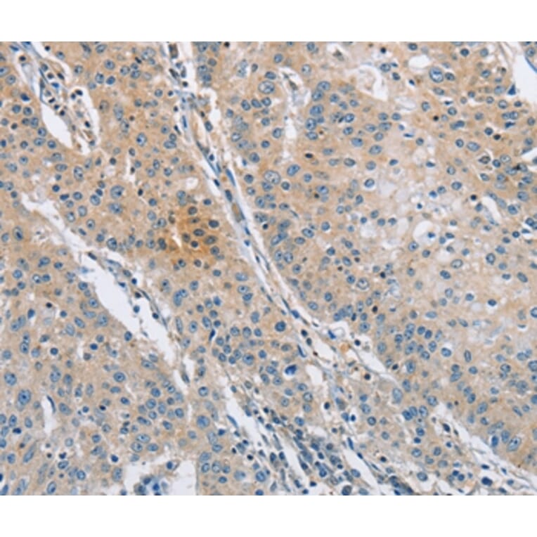 Immunohistochemistry - SH3GLB1 Antibody from Signalway Antibody (36281) - Antibodies.com