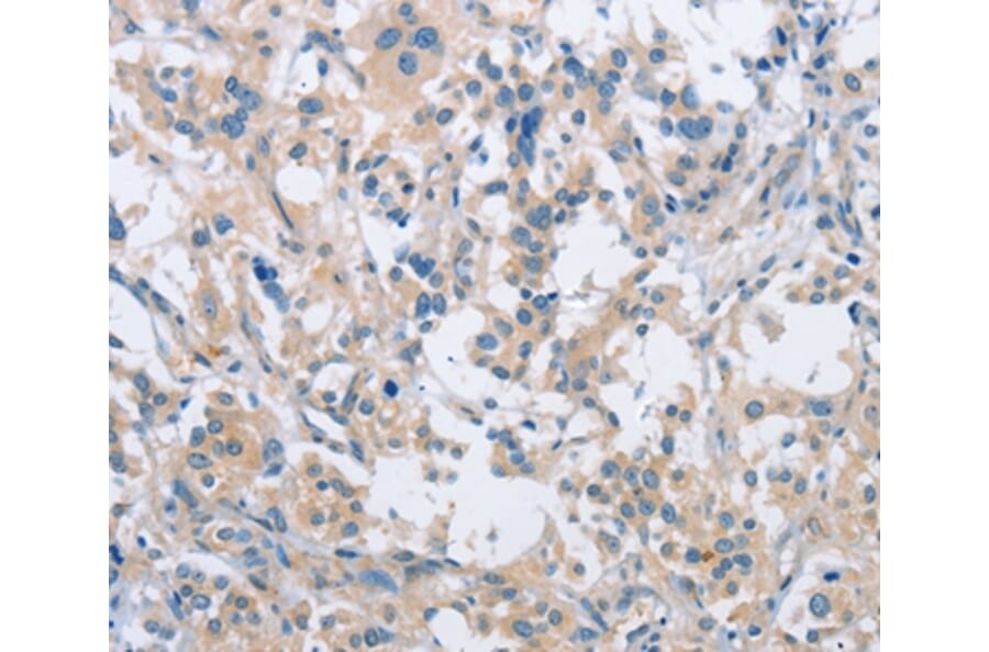Immunohistochemistry - SH3GLB1 Antibody from Signalway Antibody (36281) - Antibodies.com