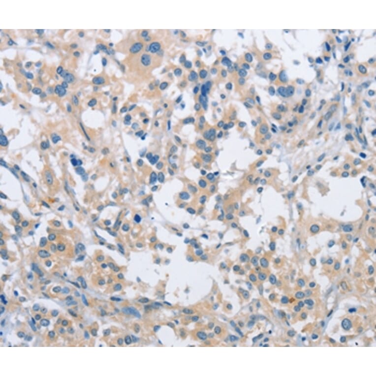 Immunohistochemistry - SH3GLB1 Antibody from Signalway Antibody (36281) - Antibodies.com