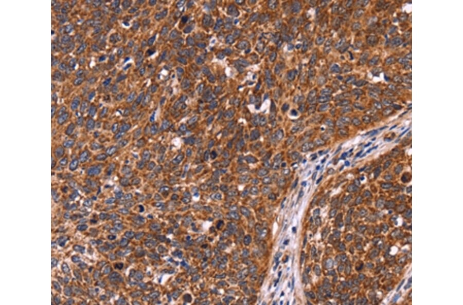 Immunohistochemistry - CCDC106 Antibody from Signalway Antibody (36316) - Antibodies.com