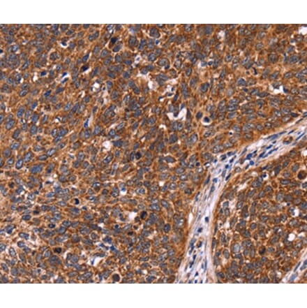 Immunohistochemistry - CCDC106 Antibody from Signalway Antibody (36316) - Antibodies.com