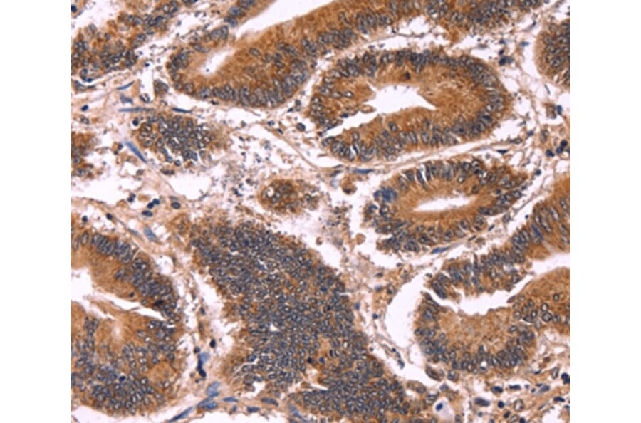 Immunohistochemistry - CCDC106 Antibody from Signalway Antibody (36316) - Antibodies.com