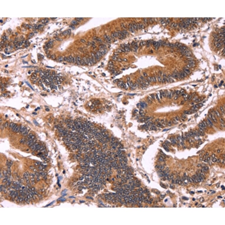 Immunohistochemistry - CCDC106 Antibody from Signalway Antibody (36316) - Antibodies.com