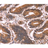 Immunohistochemistry - CCDC106 Antibody from Signalway Antibody (36316) - Antibodies.com