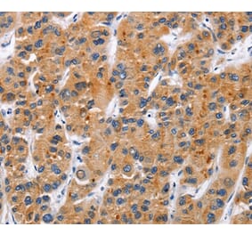Immunohistochemistry - TNFRSF9 Antibody from Signalway Antibody (36319) - Antibodies.com