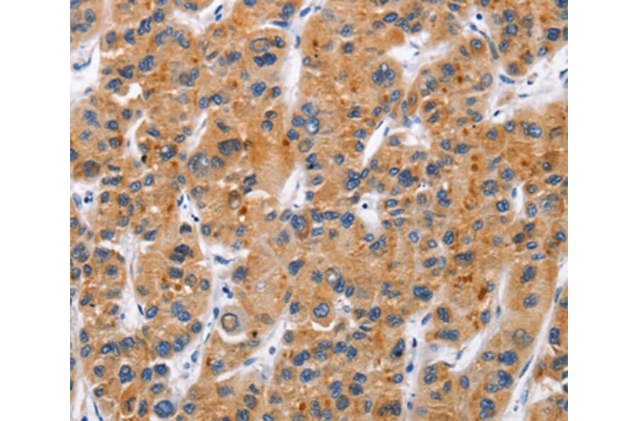 Immunohistochemistry - TNFRSF9 Antibody from Signalway Antibody (36319) - Antibodies.com