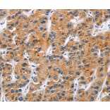 Immunohistochemistry - TNFRSF9 Antibody from Signalway Antibody (36319) - Antibodies.com