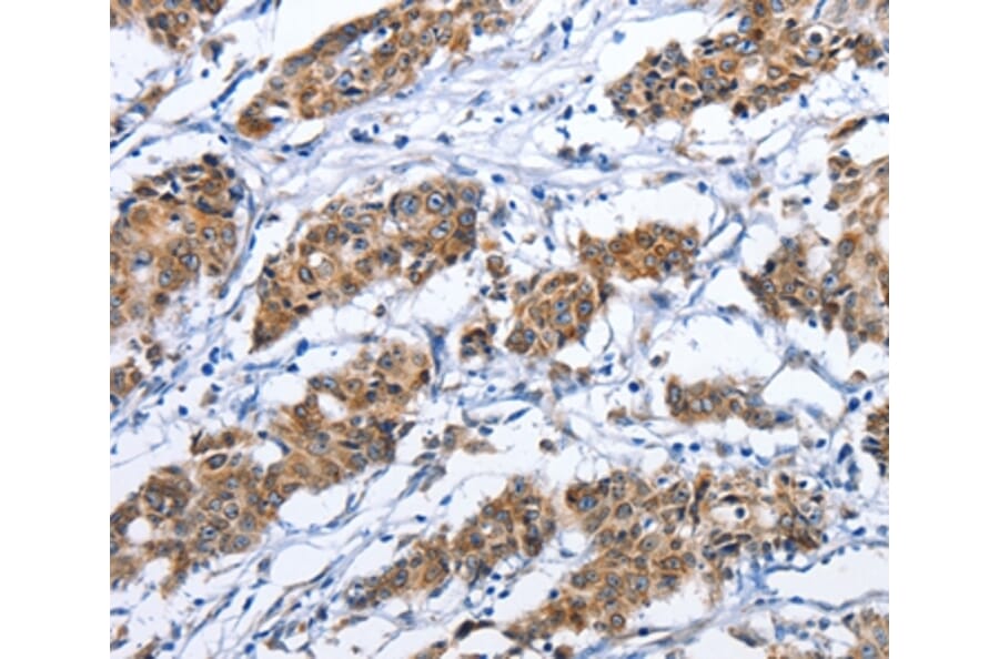 Immunohistochemistry - TNFRSF9 Antibody from Signalway Antibody (36319) - Antibodies.com