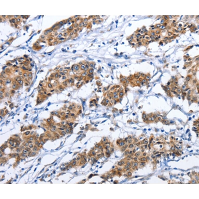 Immunohistochemistry - TNFRSF9 Antibody from Signalway Antibody (36319) - Antibodies.com