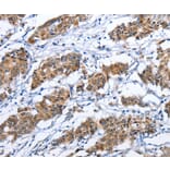Immunohistochemistry - TNFRSF9 Antibody from Signalway Antibody (36319) - Antibodies.com