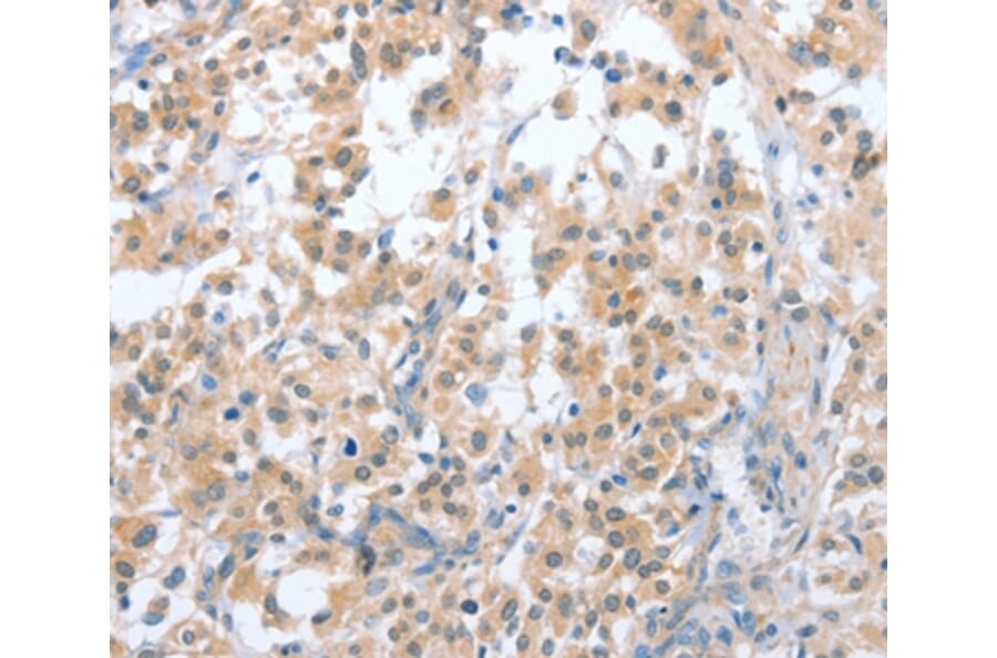 Immunohistochemistry - CD200R1 Antibody from Signalway Antibody (36327) - Antibodies.com
