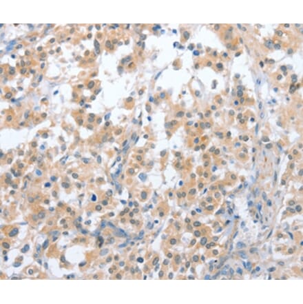 Immunohistochemistry - CD200R1 Antibody from Signalway Antibody (36327) - Antibodies.com