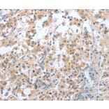 Immunohistochemistry - CD200R1 Antibody from Signalway Antibody (36327) - Antibodies.com
