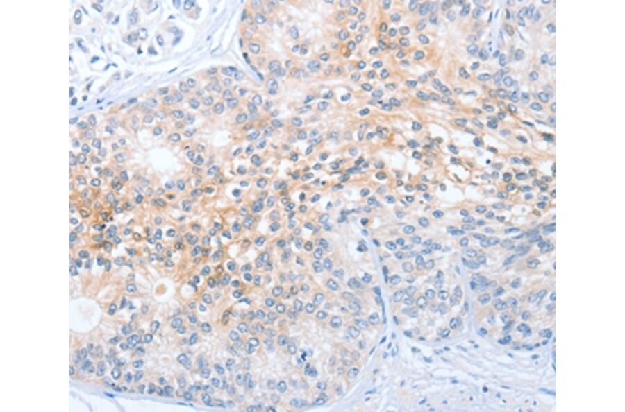 Immunohistochemistry - CD200R1 Antibody from Signalway Antibody (36327) - Antibodies.com