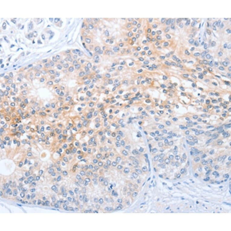 Immunohistochemistry - CD200R1 Antibody from Signalway Antibody (36327) - Antibodies.com