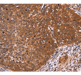 Immunohistochemistry - CDC37L1 Antibody from Signalway Antibody (36333) - Antibodies.com