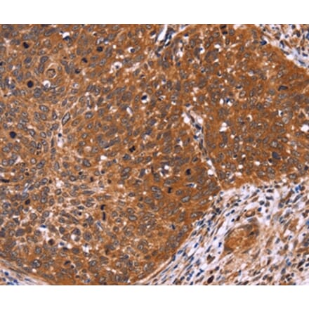 Immunohistochemistry - CDC37L1 Antibody from Signalway Antibody (36333) - Antibodies.com