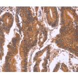 Immunohistochemistry - CDC37L1 Antibody from Signalway Antibody (36333) - Antibodies.com