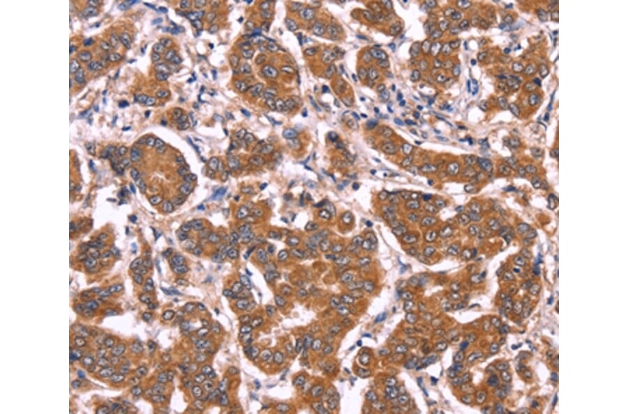 Immunohistochemistry - COL20A1 Antibody from Signalway Antibody (36361) - Antibodies.com