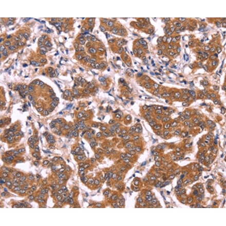 Immunohistochemistry - COL20A1 Antibody from Signalway Antibody (36361) - Antibodies.com