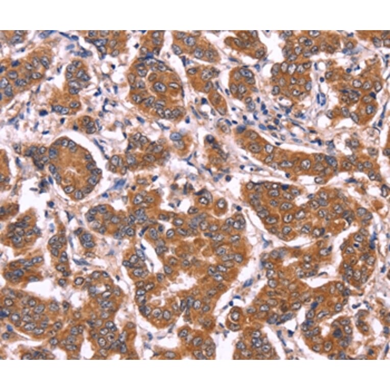 Immunohistochemistry - COL20A1 Antibody from Signalway Antibody (36361) - Antibodies.com