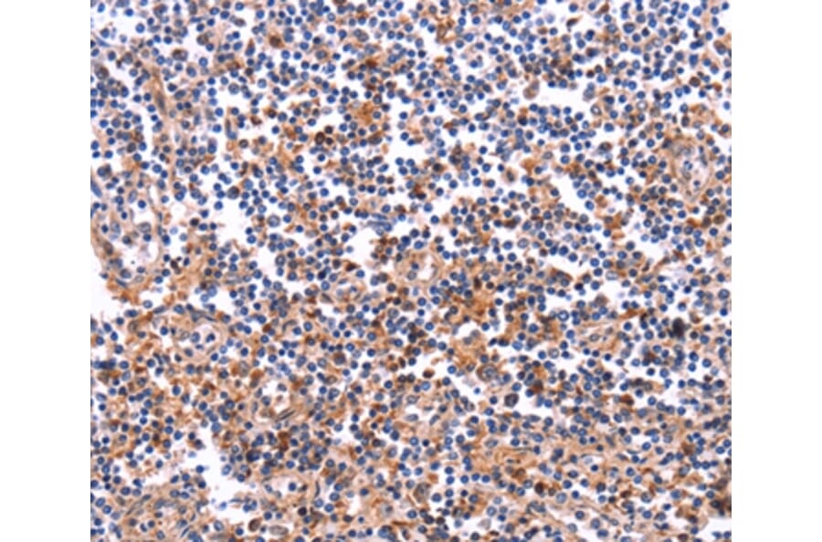 Immunohistochemistry - COL20A1 Antibody from Signalway Antibody (36361) - Antibodies.com