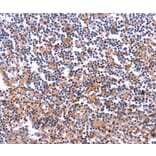Immunohistochemistry - COL20A1 Antibody from Signalway Antibody (36361) - Antibodies.com