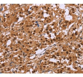 Immunohistochemistry - CTNNBL1 Antibody from Signalway Antibody (36378) - Antibodies.com