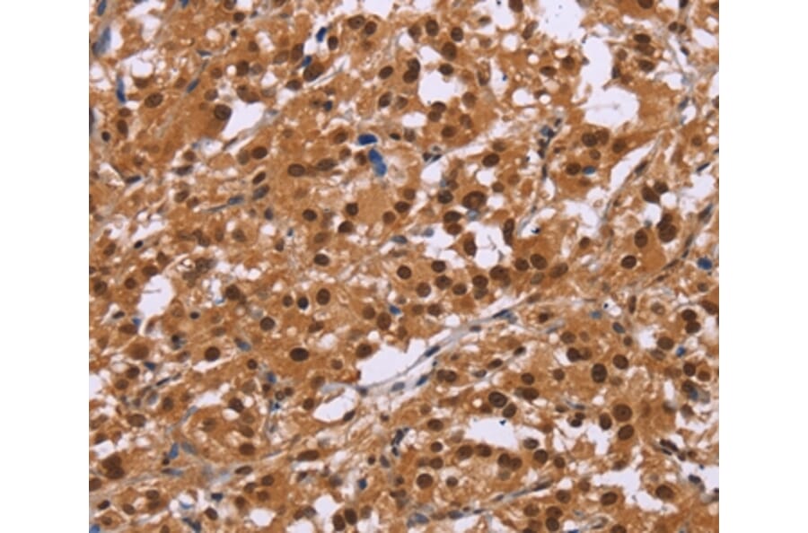 Immunohistochemistry - CTNNBL1 Antibody from Signalway Antibody (36378) - Antibodies.com