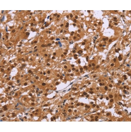 Immunohistochemistry - CTNNBL1 Antibody from Signalway Antibody (36378) - Antibodies.com