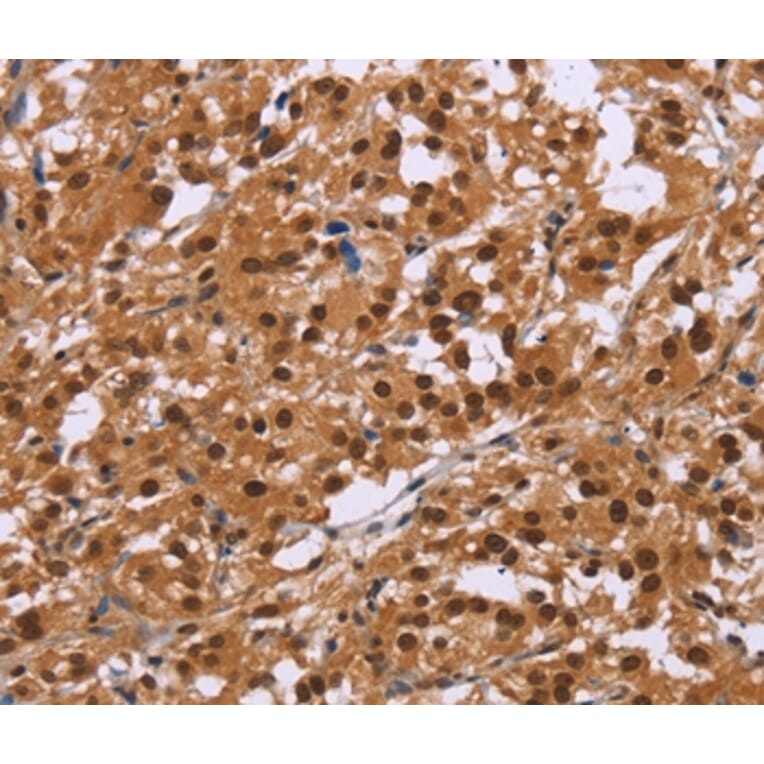 Immunohistochemistry - CTNNBL1 Antibody from Signalway Antibody (36378) - Antibodies.com