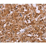Immunohistochemistry - CTNNBL1 Antibody from Signalway Antibody (36378) - Antibodies.com