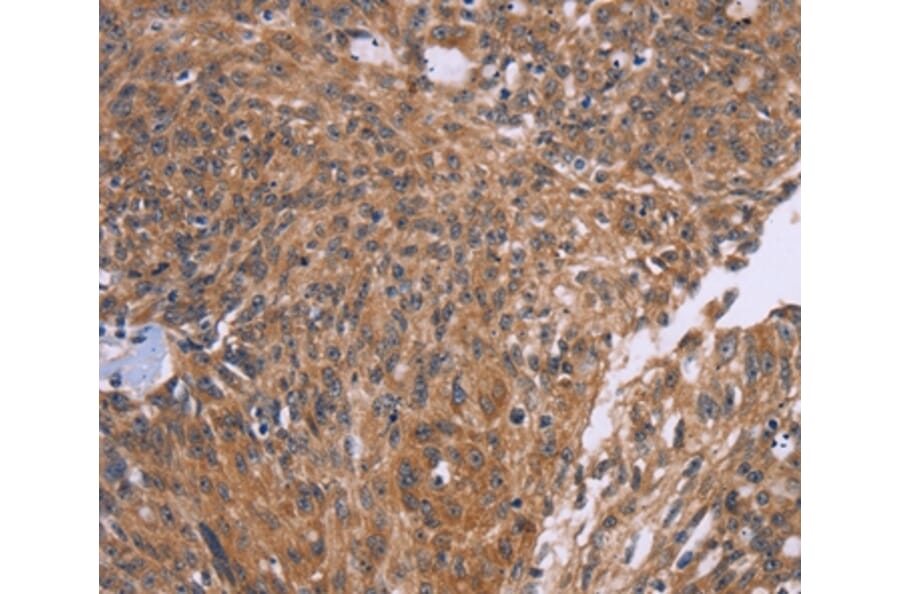 Immunohistochemistry - CTNNBL1 Antibody from Signalway Antibody (36378) - Antibodies.com