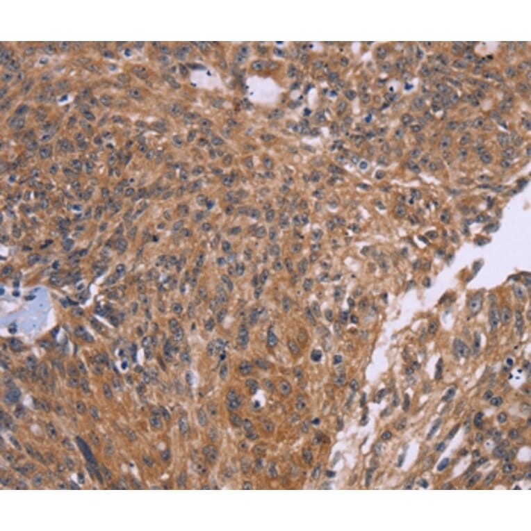 Immunohistochemistry - CTNNBL1 Antibody from Signalway Antibody (36378) - Antibodies.com