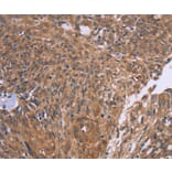 Immunohistochemistry - CTNNBL1 Antibody from Signalway Antibody (36378) - Antibodies.com