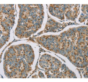 Immunohistochemistry - CYP11B1 Antibody from Signalway Antibody (36386) - Antibodies.com