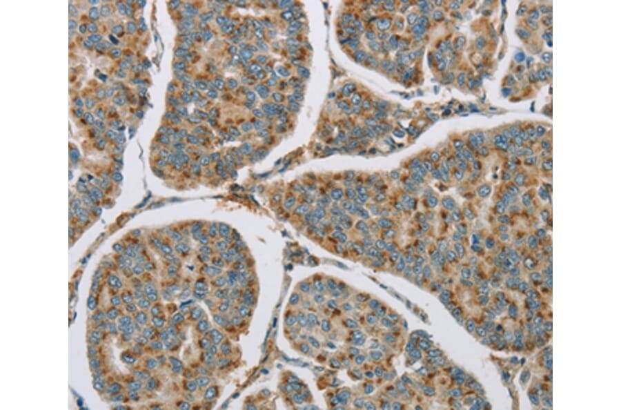 Immunohistochemistry - CYP11B1 Antibody from Signalway Antibody (36386) - Antibodies.com