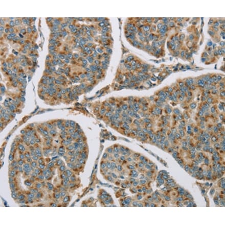 Immunohistochemistry - CYP11B1 Antibody from Signalway Antibody (36386) - Antibodies.com