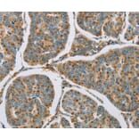 Immunohistochemistry - CYP11B1 Antibody from Signalway Antibody (36386) - Antibodies.com