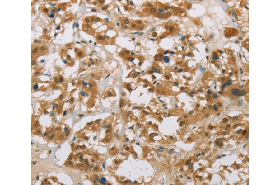 Immunohistochemistry - CYP11B1 Antibody from Signalway Antibody (36386) - Antibodies.com