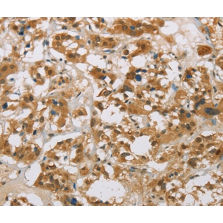 Immunohistochemistry - CYP11B1 Antibody from Signalway Antibody (36386) - Antibodies.com