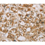 Immunohistochemistry - CYP11B1 Antibody from Signalway Antibody (36386) - Antibodies.com