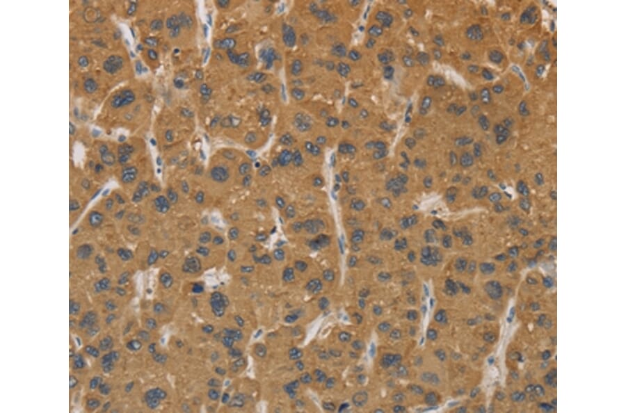 Immunohistochemistry - CYP17A1 Antibody from Signalway Antibody (36388) - Antibodies.com