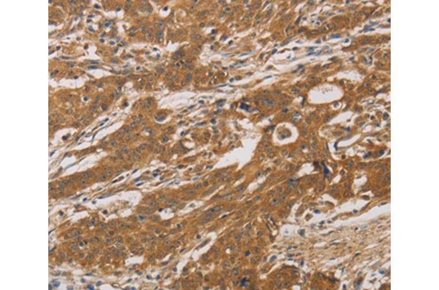 Immunohistochemistry - CYP17A1 Antibody from Signalway Antibody (36388) - Antibodies.com