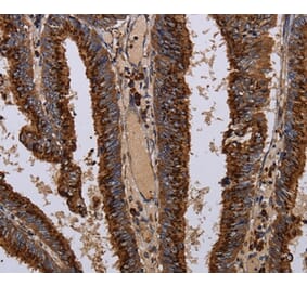 Immunohistochemistry - PPP1R1B Antibody from Signalway Antibody (36398) - Antibodies.com