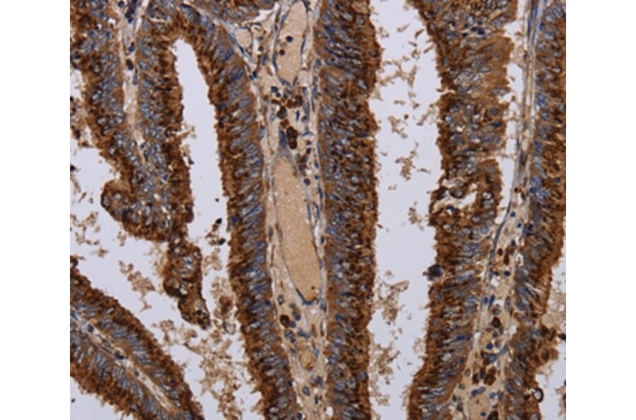 Immunohistochemistry - PPP1R1B Antibody from Signalway Antibody (36398) - Antibodies.com